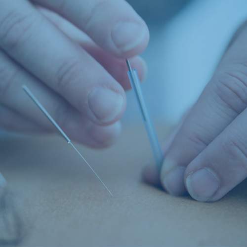 Acupuncture Billing Services